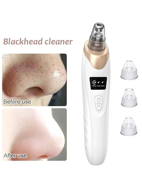 USB Rechargeable Blackhead Remover & Derma Suction Facial Cleansing Device